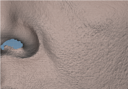 NIASKIN - Photo in vivo site interne AFTER