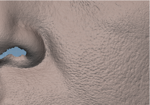 NIASKIN - Photo in vivo site internet BEFORE