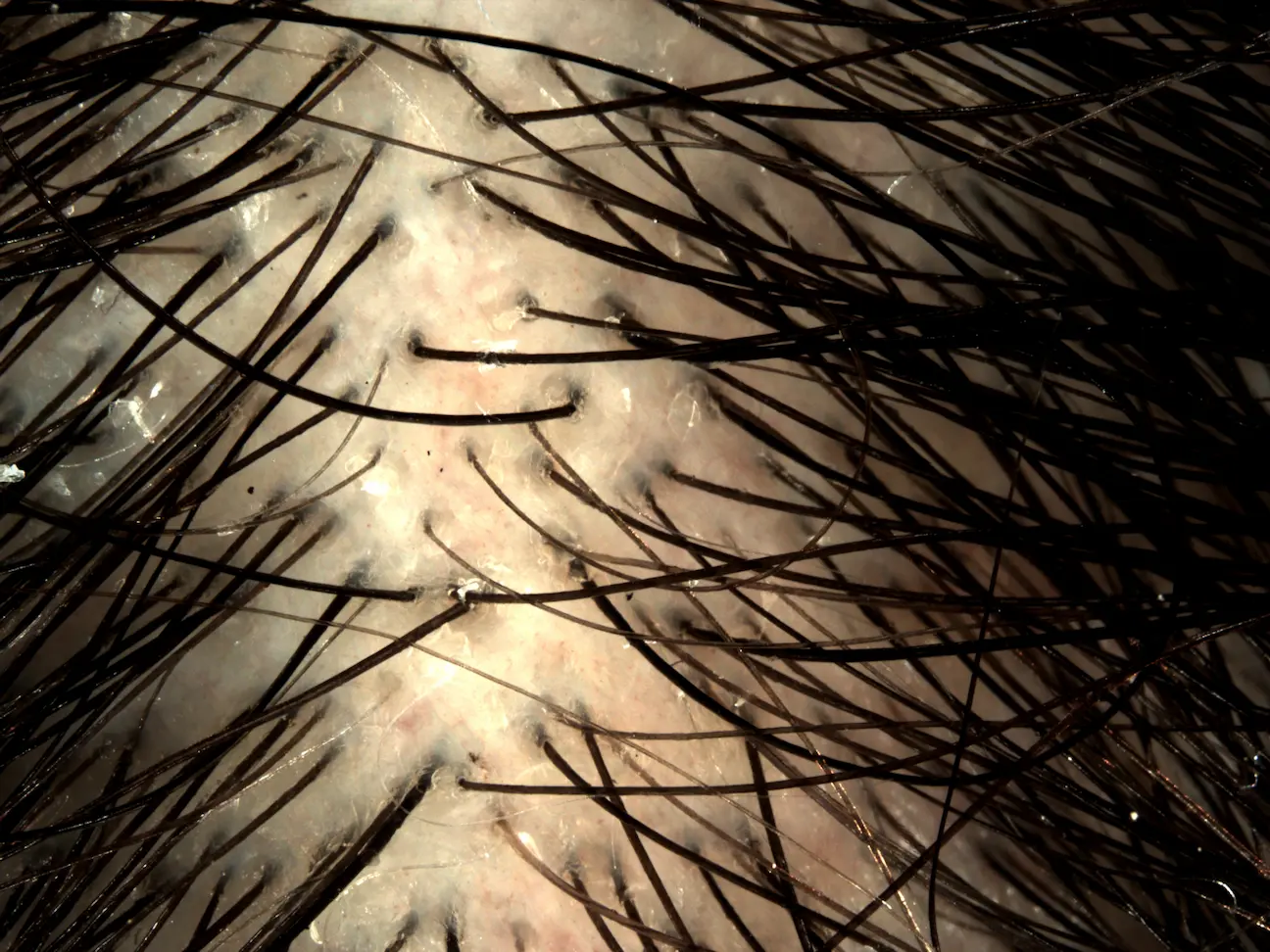 SCAPILYA - Photo dandruff D28 (vol. 8)