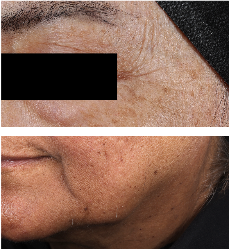 SHISOME - Photo in vivo site internet APRES