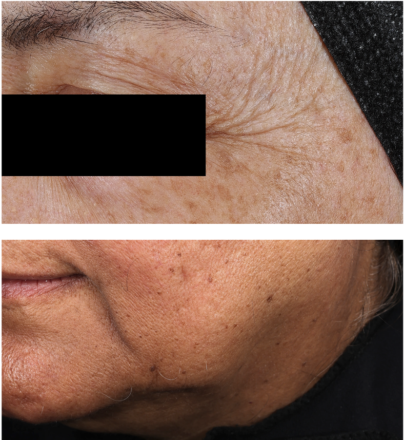 SHISOME - Photo in vivo site internet AVANT