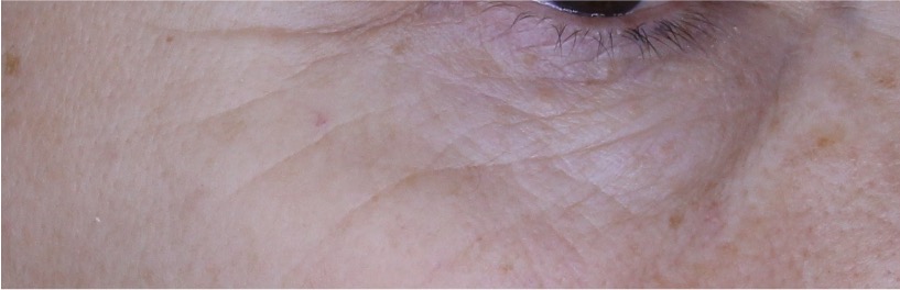 SUNGLOWER - Photo in vivo site internet AFTER